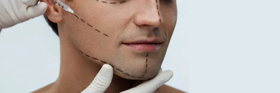 Jawline (Çene Hattı) Dolgusu